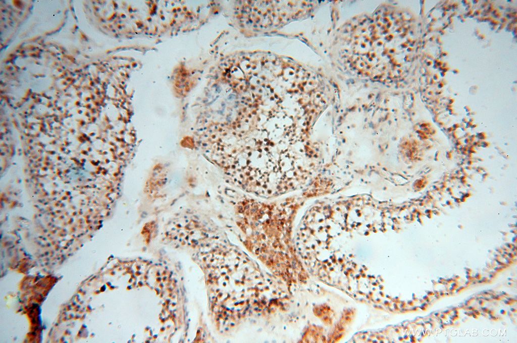 Immunohistochemistry (IHC) staining of human testis tissue using USP20 Polyclonal antibody (17491-1-AP)