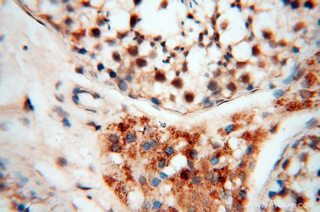 Immunohistochemistry (IHC) staining of human testis tissue using USP20 Polyclonal antibody (17491-1-AP)