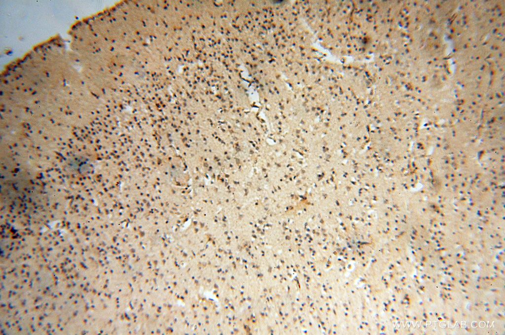 Immunohistochemistry (IHC) staining of human brain tissue using USP20 Polyclonal antibody (17491-1-AP)