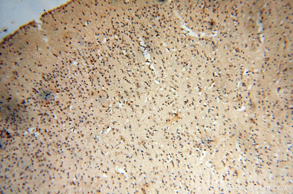 IHC staining of human brain using 17491-1-AP