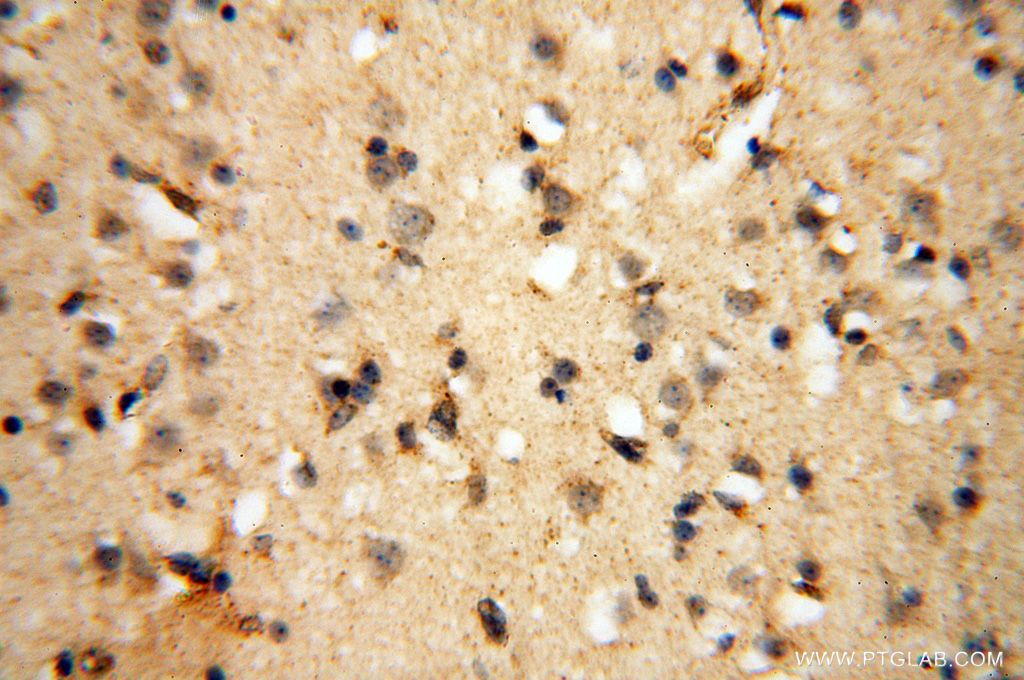 IHC staining of human brain using 17491-1-AP