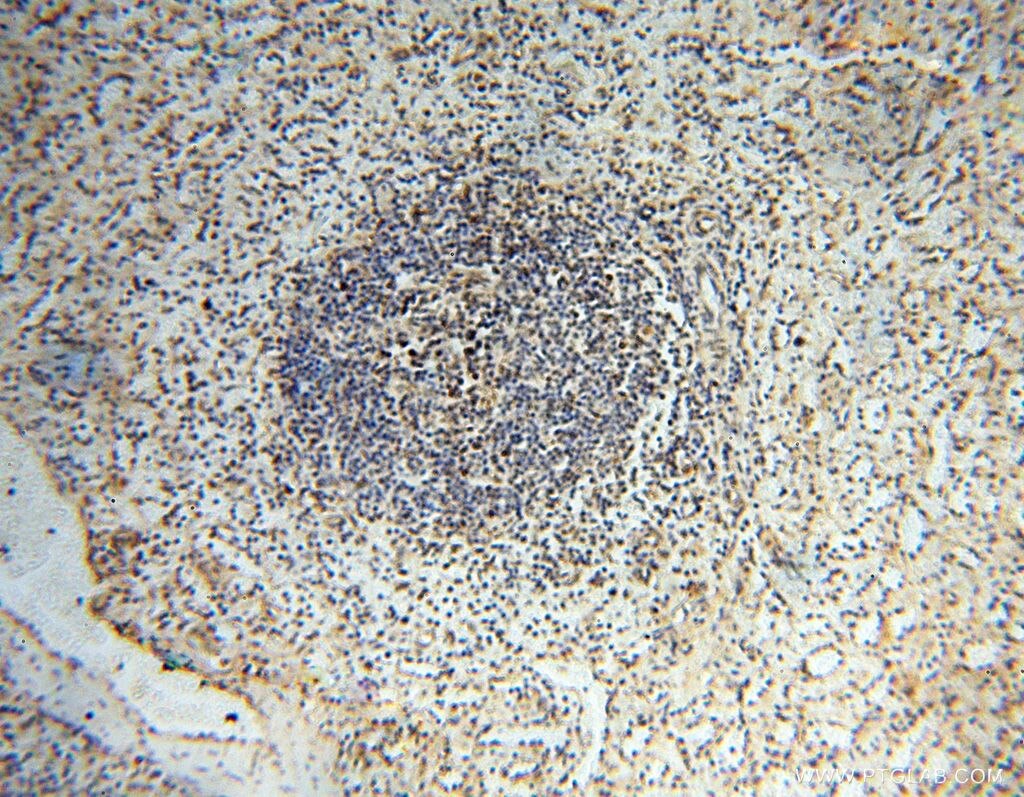 Immunohistochemistry (IHC) staining of human spleen tissue using USP20 Polyclonal antibody (17491-1-AP)