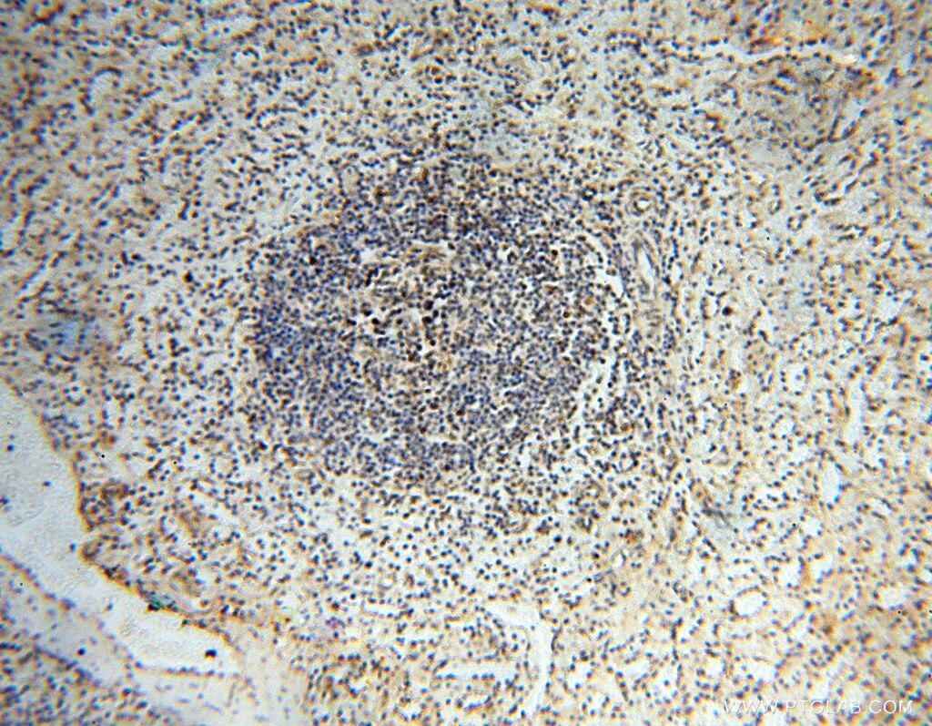 Immunohistochemistry (IHC) staining of human spleen tissue using USP20 Polyclonal antibody (17491-1-AP)