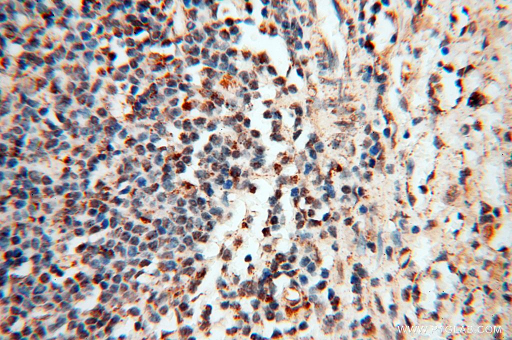 Immunohistochemistry (IHC) staining of human spleen tissue using USP20 Polyclonal antibody (17491-1-AP)
