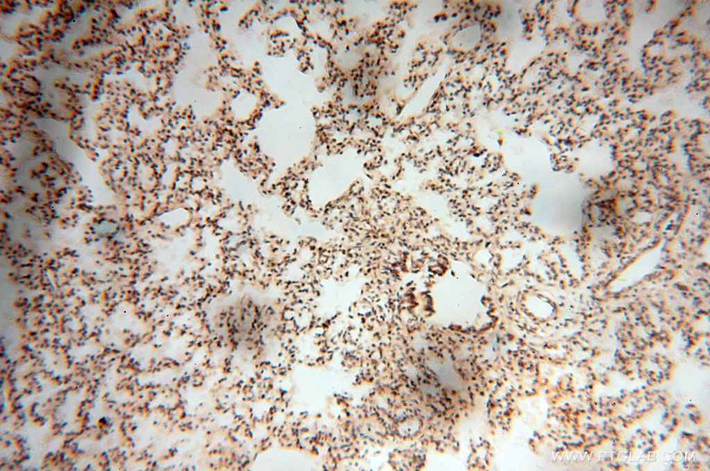 IHC staining of human lung using 17491-1-AP