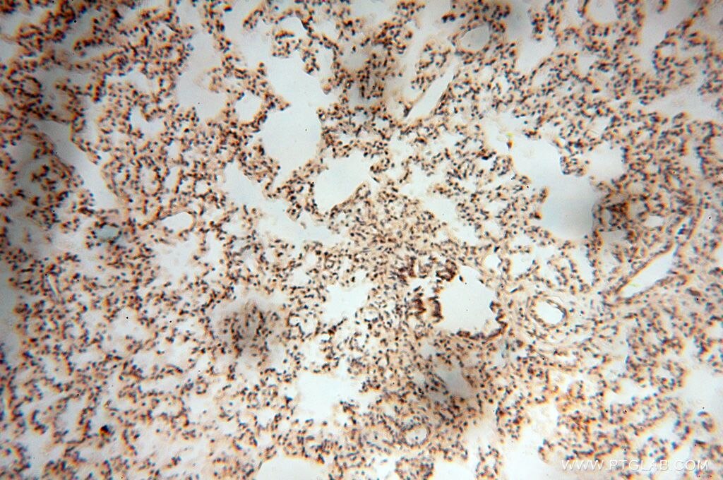 Immunohistochemistry (IHC) staining of human lung tissue using USP20 Polyclonal antibody (17491-1-AP)