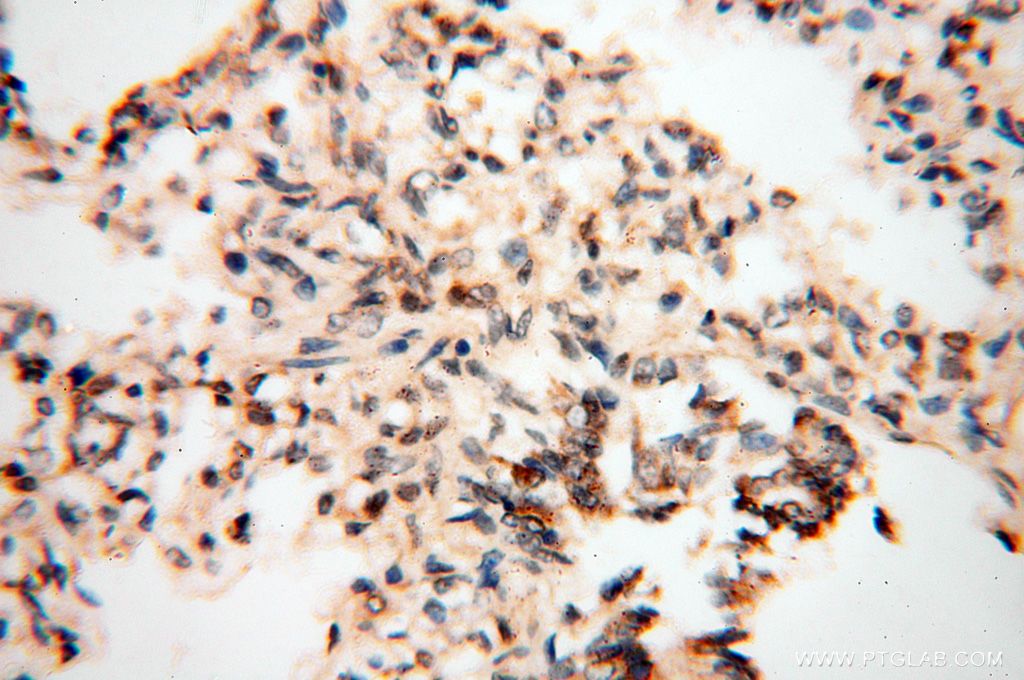 Immunohistochemistry (IHC) staining of human lung tissue using USP20 Polyclonal antibody (17491-1-AP)