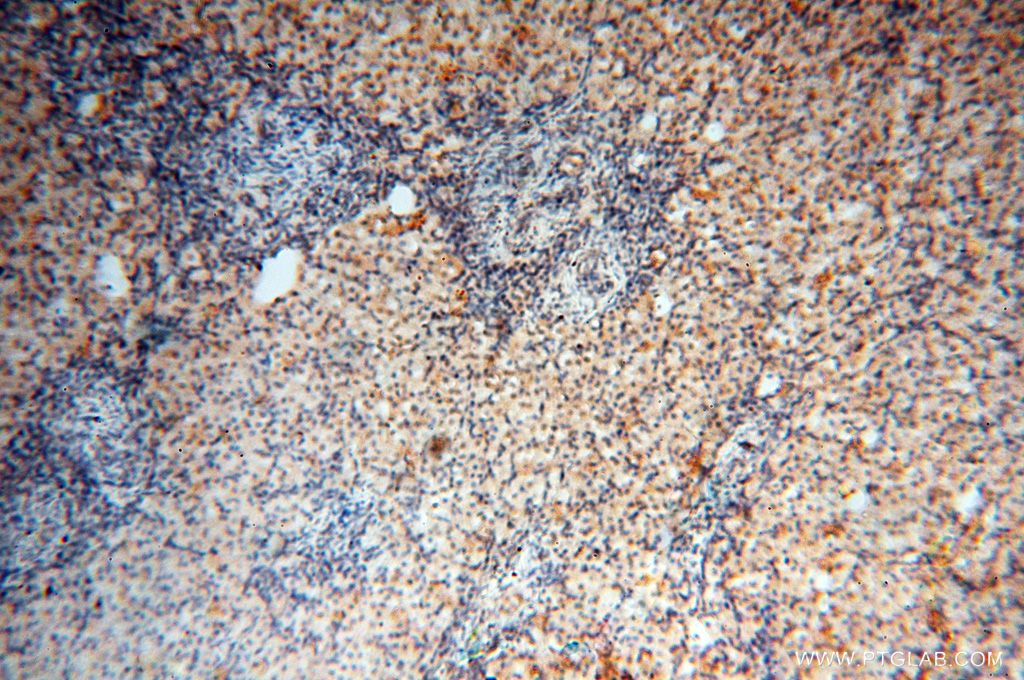 IHC staining of human ovary using 17491-1-AP