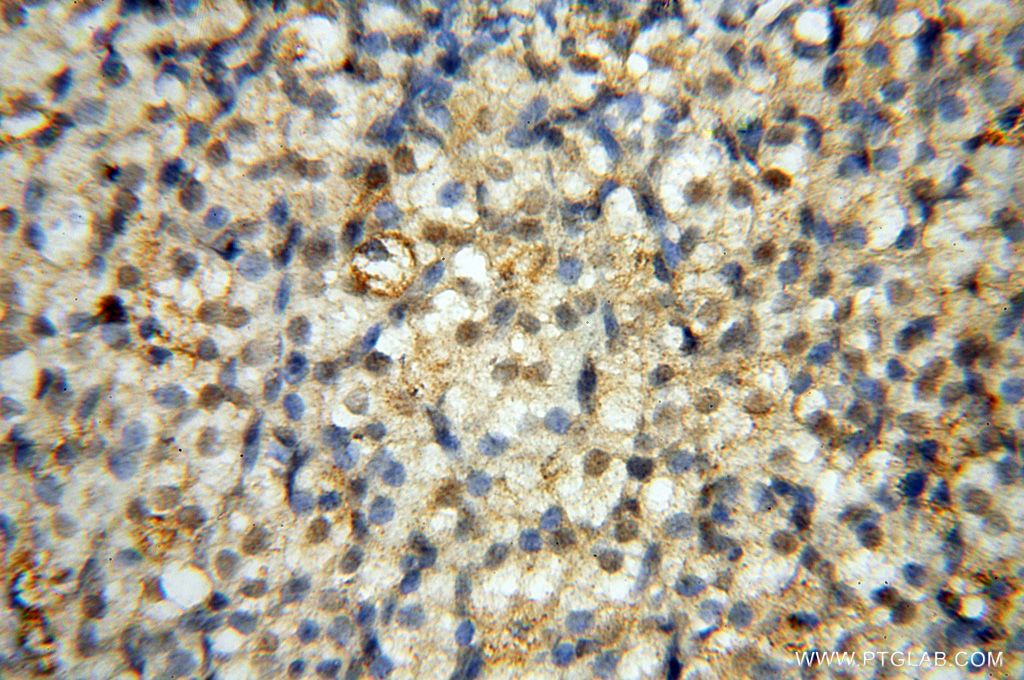 Immunohistochemistry (IHC) staining of human ovary tissue using USP20 Polyclonal antibody (17491-1-AP)