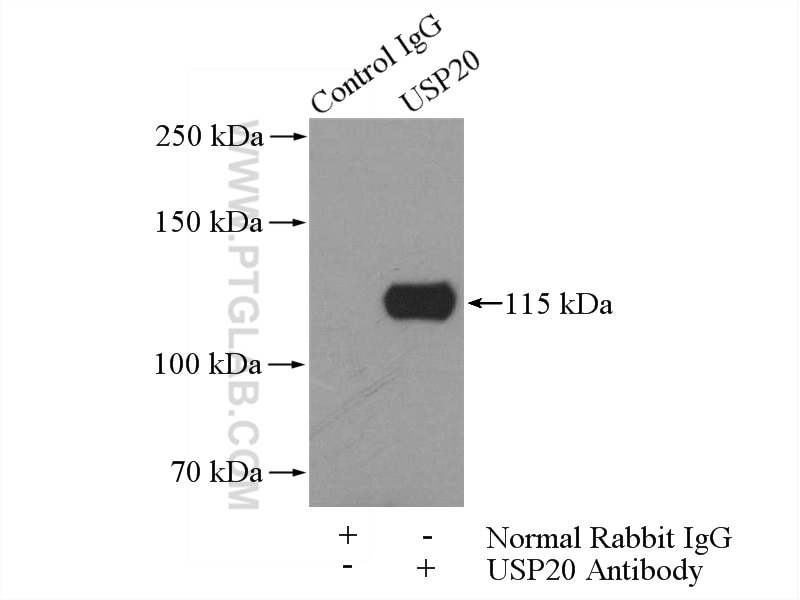 Immunoprecipitation (IP) experiment of HeLa cells using USP20 Polyclonal antibody (17491-1-AP)