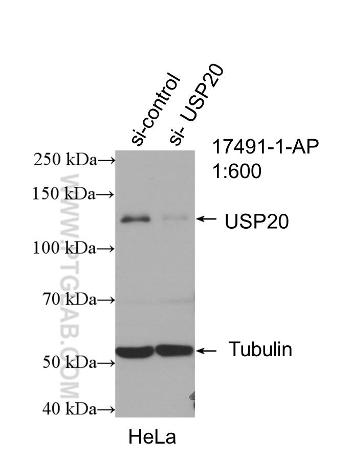 Western Blot (WB) analysis of HeLa cells using USP20 Polyclonal antibody (17491-1-AP)