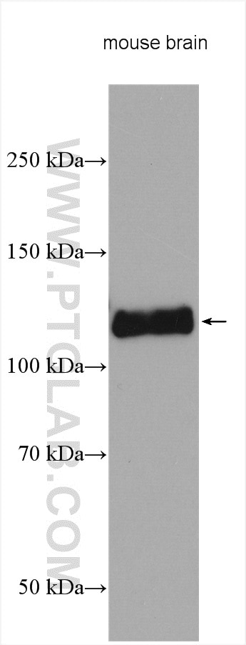 Western Blot (WB) analysis of various lysates using USP20 Polyclonal antibody (17491-1-AP)