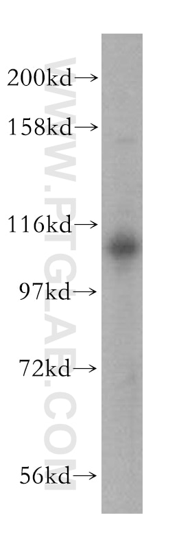 Western Blot (WB) analysis of HepG2 cells using USP20 Polyclonal antibody (17491-1-AP)