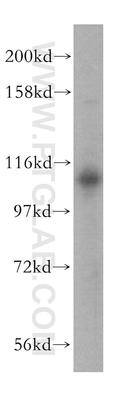 WB analysis of HepG2 using 17491-1-AP