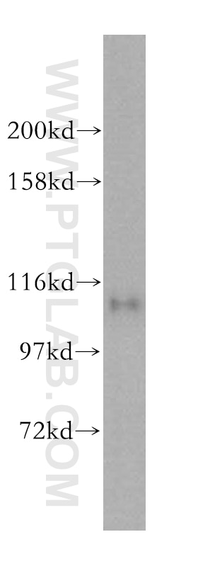 Western Blot (WB) analysis of HeLa cells using USP20 Polyclonal antibody (17491-1-AP)
