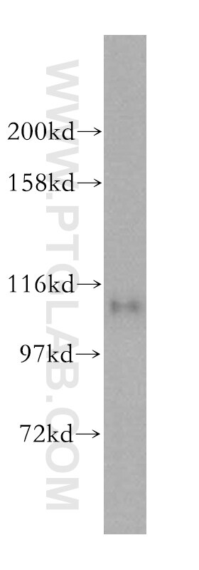 Western Blot (WB) analysis of HeLa cells using USP20 Polyclonal antibody (17491-1-AP)