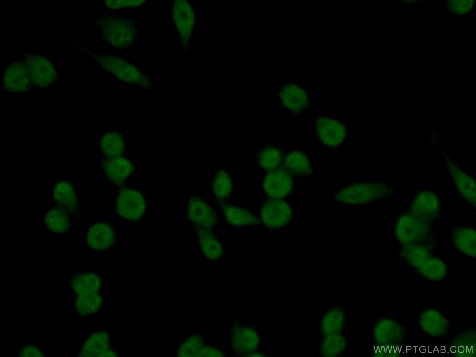 Immunofluorescence (IF) / fluorescent staining of RAW 264.7 cells using USP21 Polyclonal antibody (17856-1-AP)