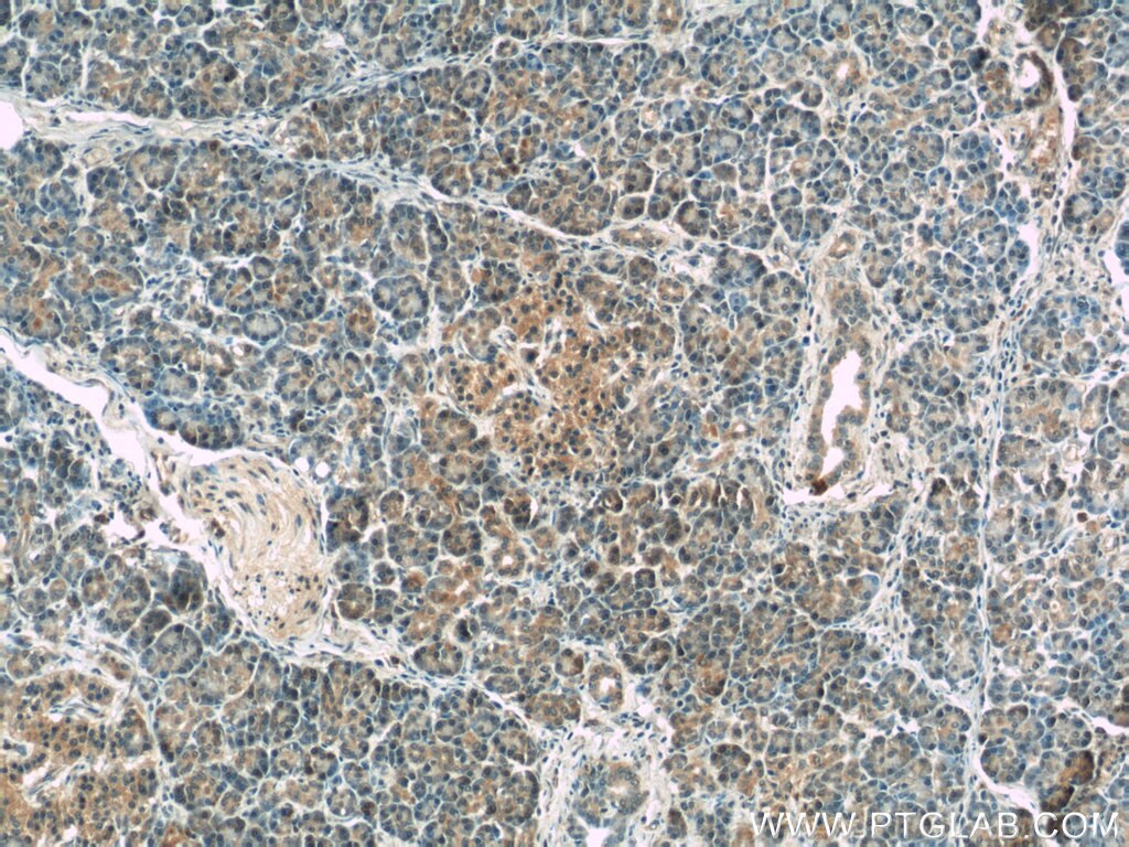 Immunohistochemistry (IHC) staining of human pancreas tissue using USP21 Polyclonal antibody (17856-1-AP)