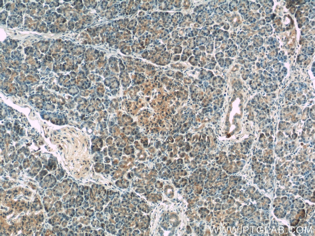 IHC staining of human pancreas using 17856-1-AP