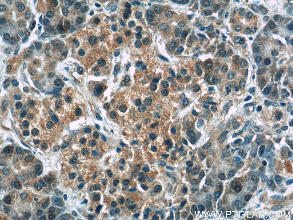 IHC staining of human pancreas using 17856-1-AP