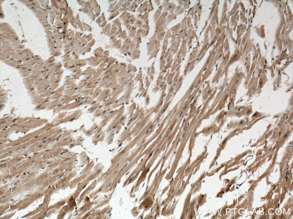 Immunohistochemistry (IHC) staining of mouse heart tissue using USP21 Polyclonal antibody (17856-1-AP)