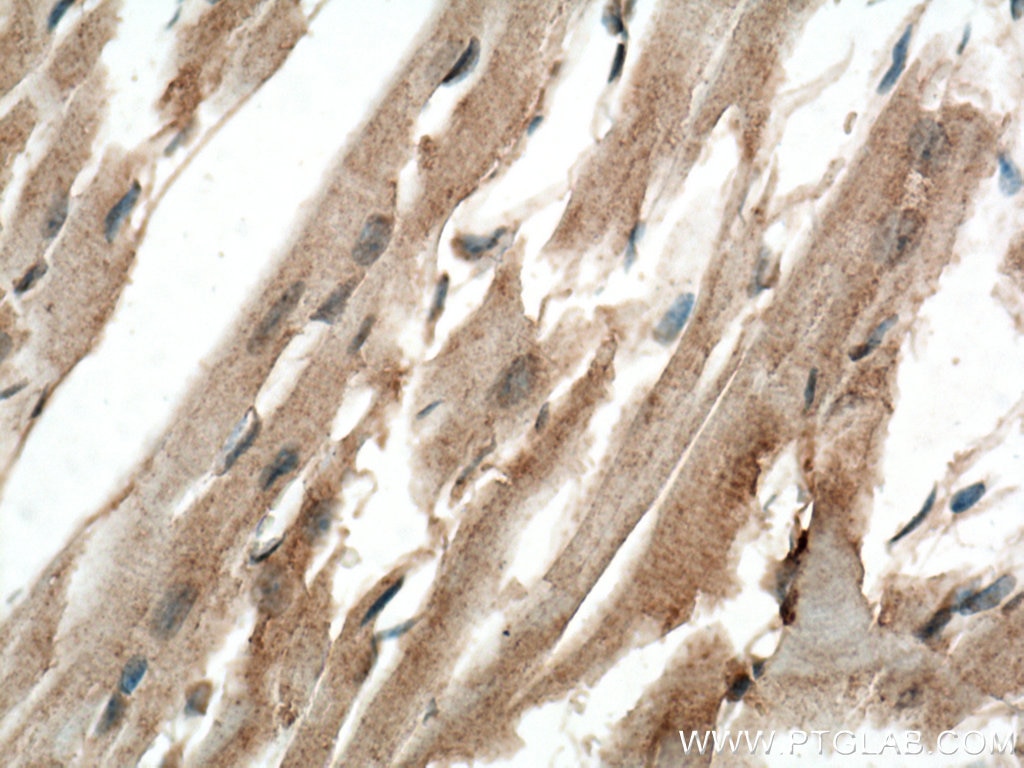 Immunohistochemistry (IHC) staining of mouse heart tissue using USP21 Polyclonal antibody (17856-1-AP)