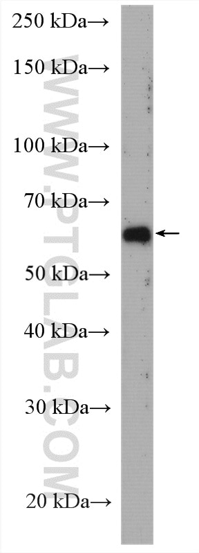 Western Blot (WB) analysis of RAW 264.7 cells using USP21 Polyclonal antibody (17856-1-AP)