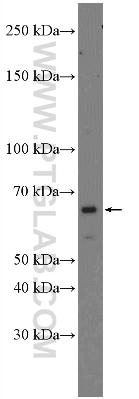 Western Blot (WB) analysis of RAW 264.7 cells using USP21 Polyclonal antibody (17856-1-AP)