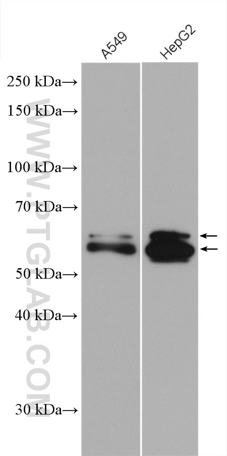 Western Blot (WB) analysis of various lysates using USP22 Polyclonal antibody (55110-1-AP)