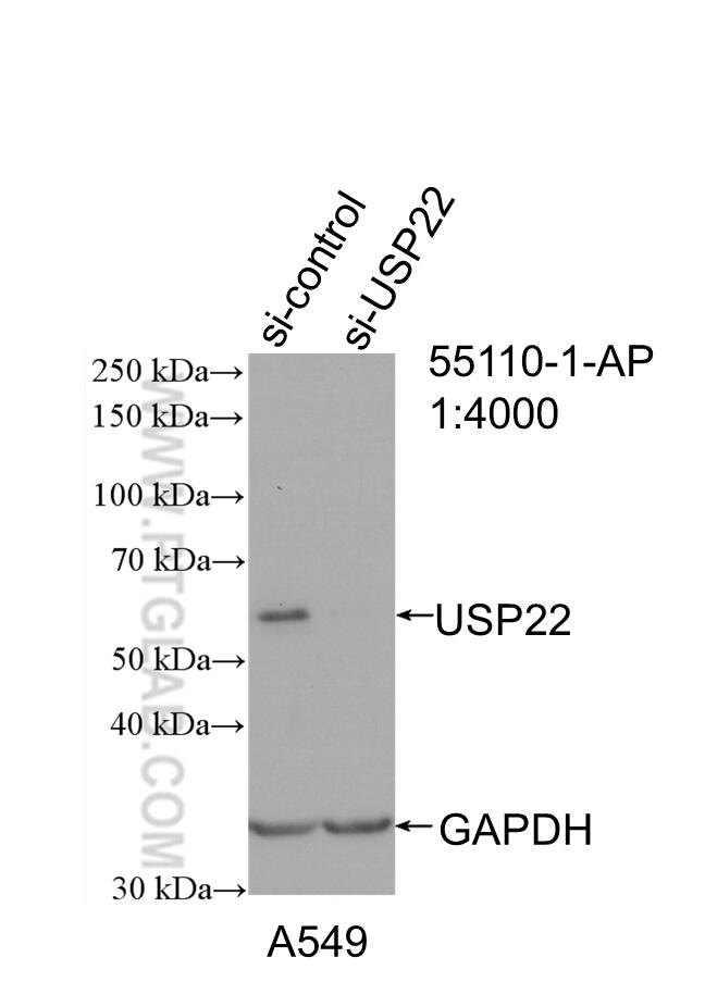 Western Blot (WB) analysis of A549 cells using USP22 Polyclonal antibody (55110-1-AP)
