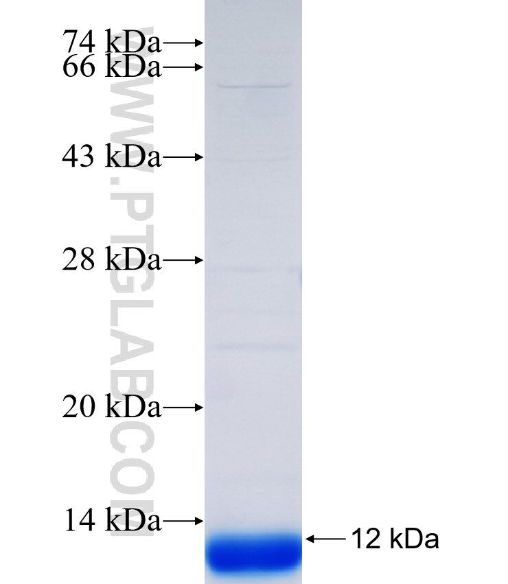 USP22 fusion protein Ag34933 SDS-PAGE USP22 fusion protein Ag34933 SDS-PAGE