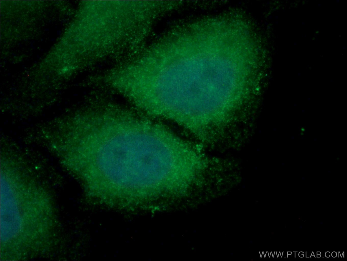 Immunofluorescence (IF) / fluorescent staining of HeLa cells using USP24 Polyclonal antibody (13126-1-AP)