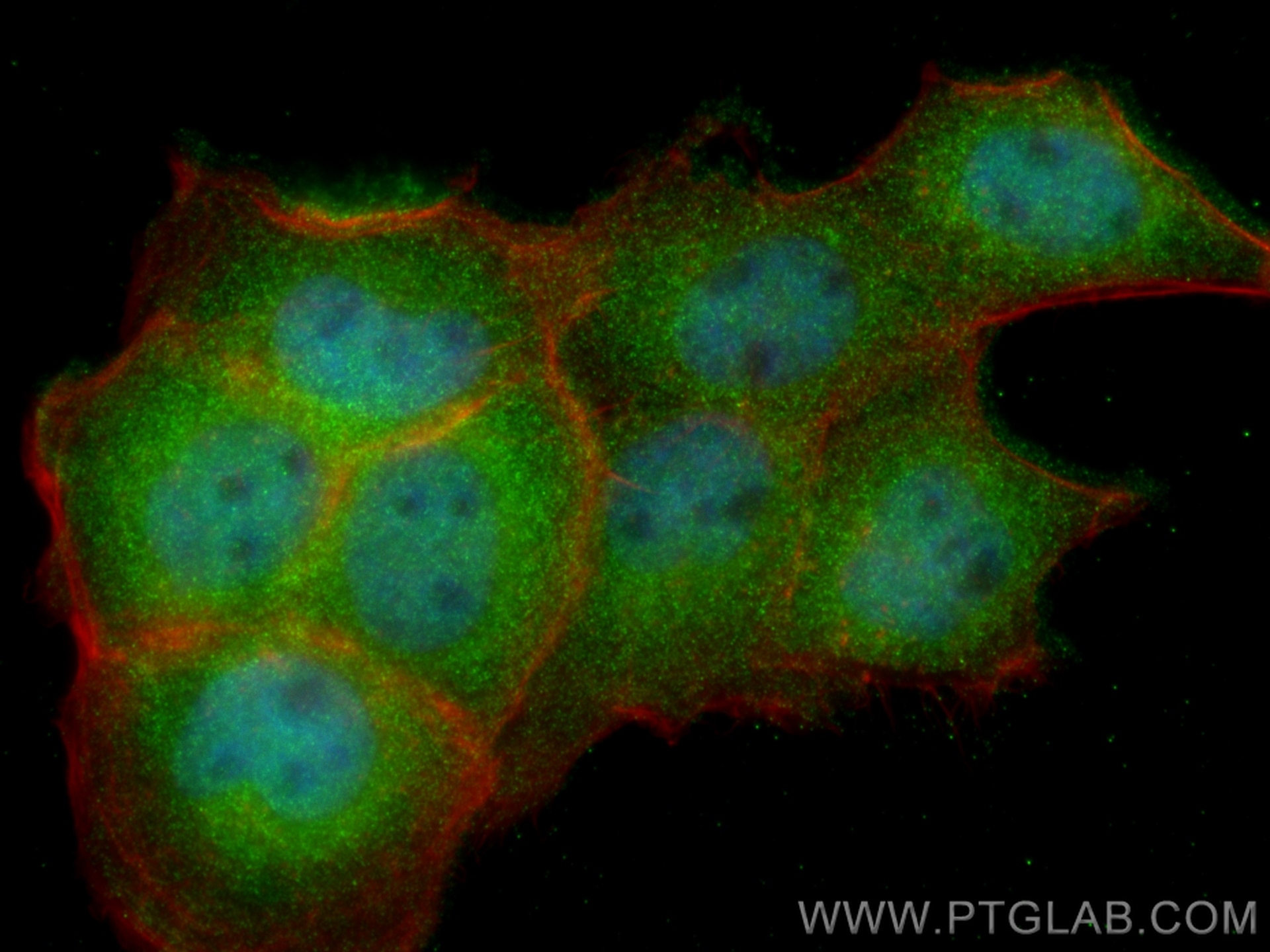 Immunofluorescence (IF) / fluorescent staining of A431 cells using USP24 Polyclonal antibody (13126-1-AP)