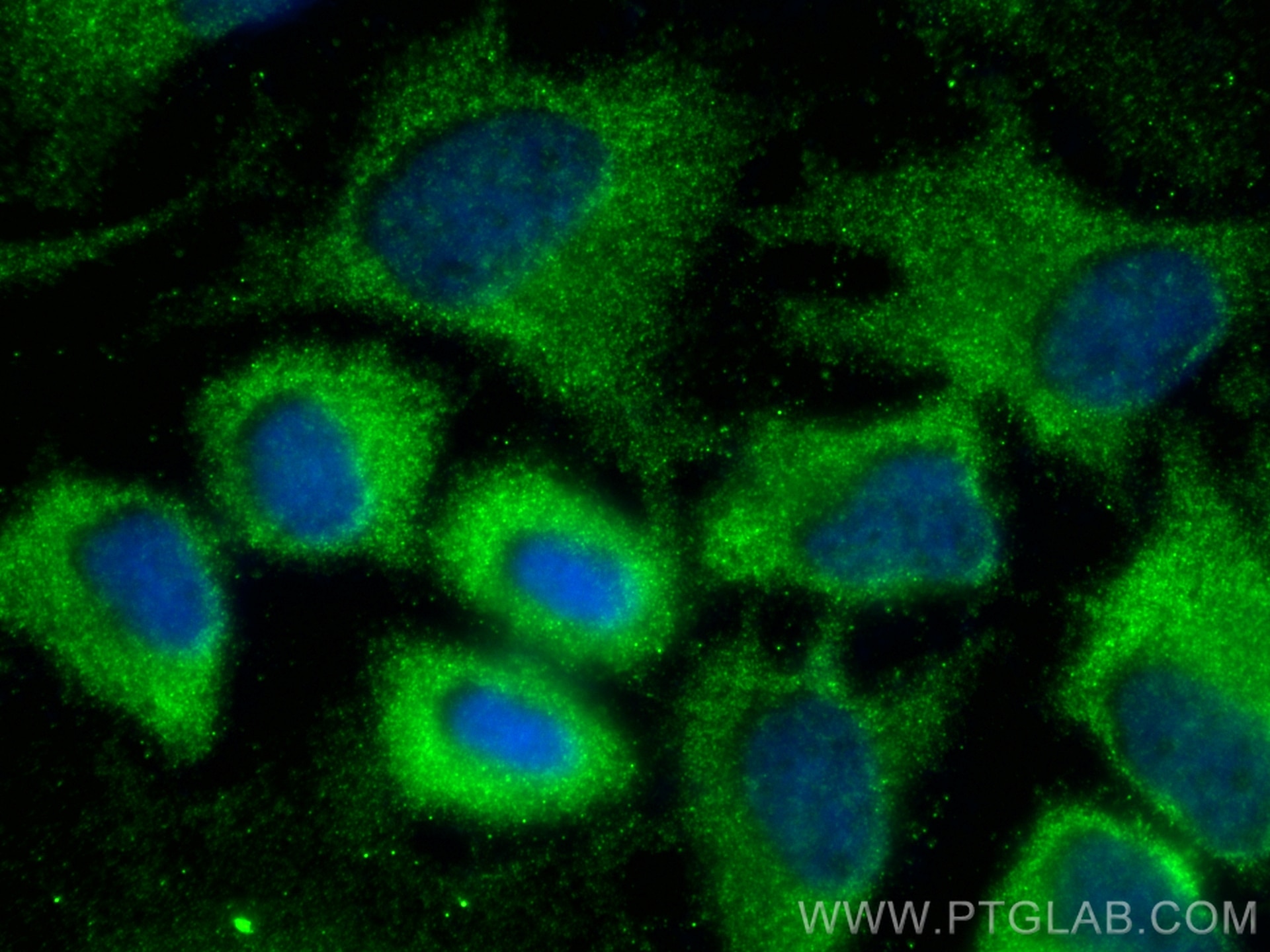 Immunofluorescence (IF) / fluorescent staining of HeLa cells using USP24 Polyclonal antibody (13126-1-AP)