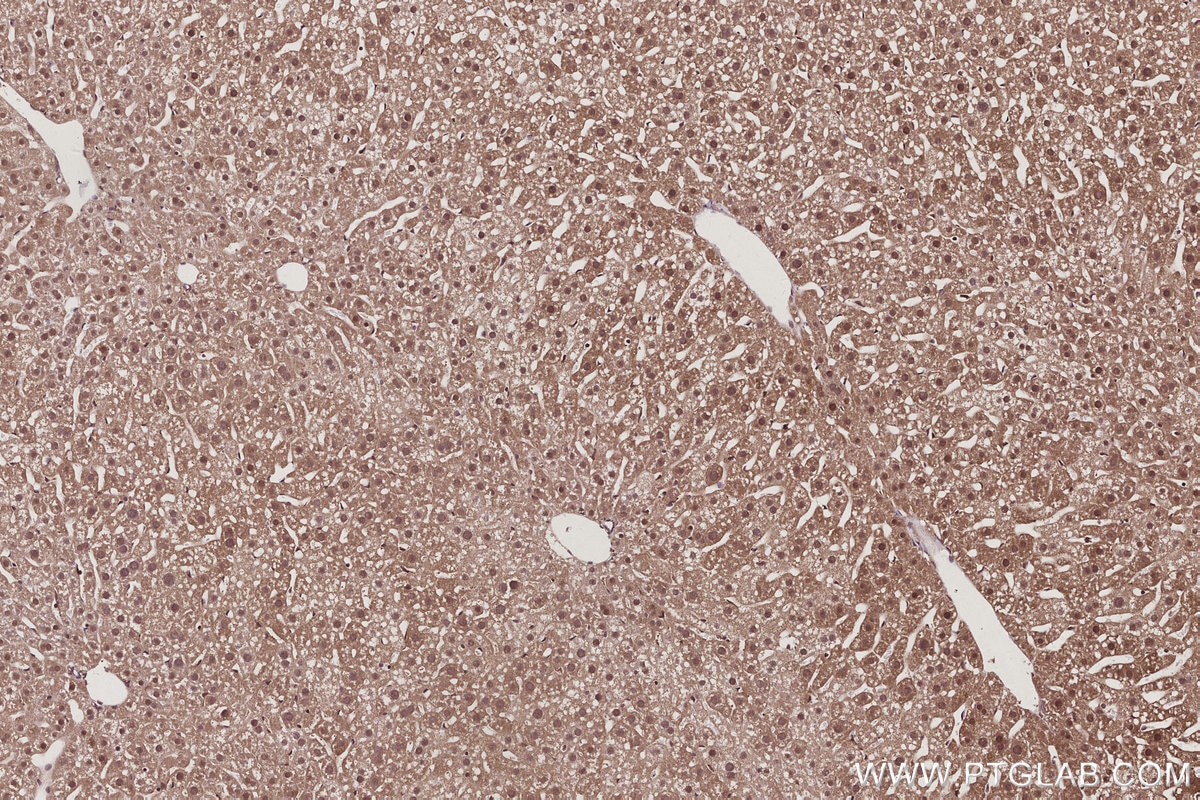 IHC staining of mouse liver using 13126-1-AP Immunohistochemistry (IHC) staining of mouse liver tissue using USP24 Polyclonal antibody (13126-1-AP)