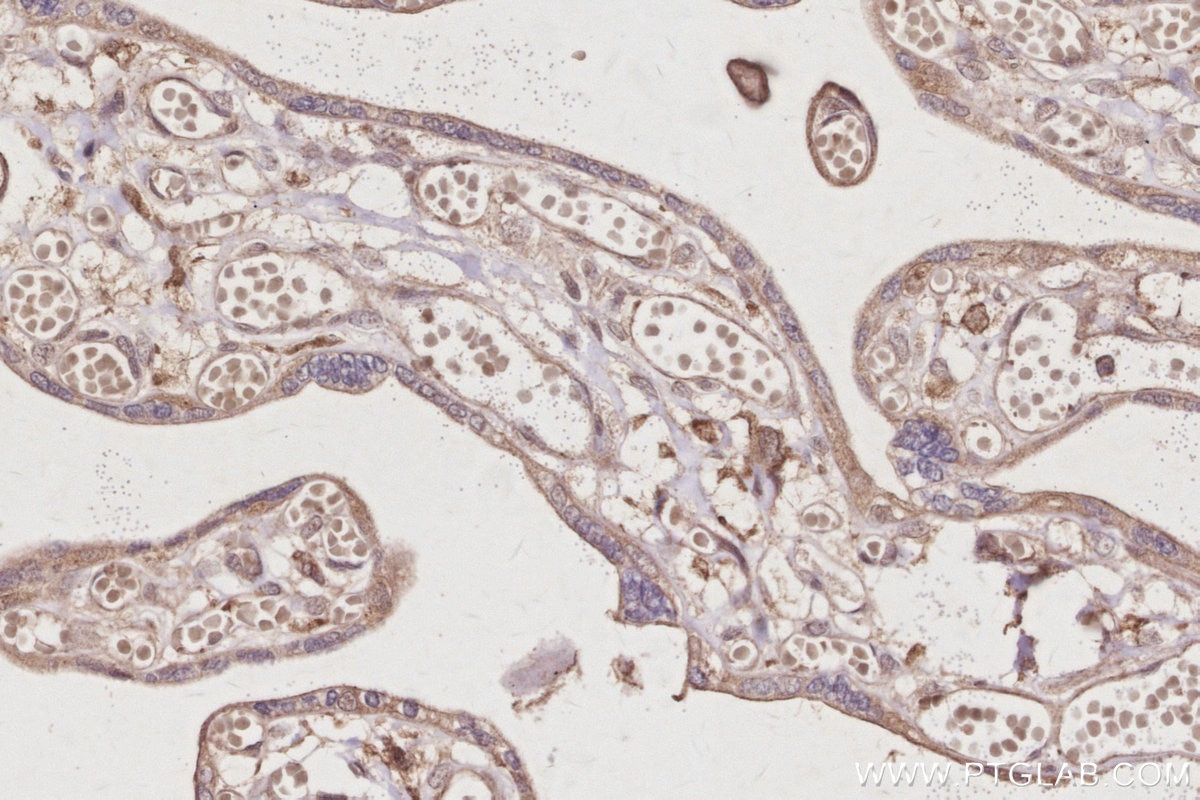 IHC staining of human placenta using 13126-1-AP Immunohistochemistry (IHC) staining of human placenta tissue using USP24 Polyclonal antibody (13126-1-AP)