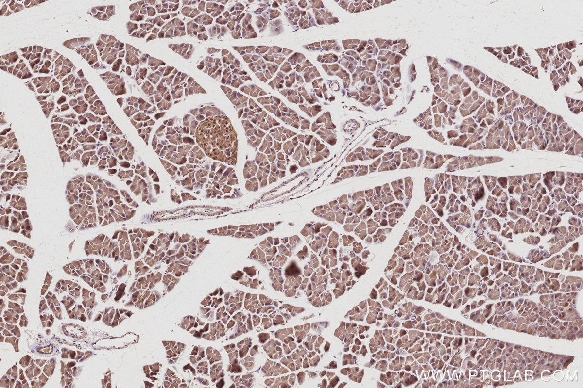 IHC staining of mouse pancreas using 13126-1-AP Immunohistochemistry (IHC) staining of mouse pancreas tissue using USP24 Polyclonal antibody (13126-1-AP)