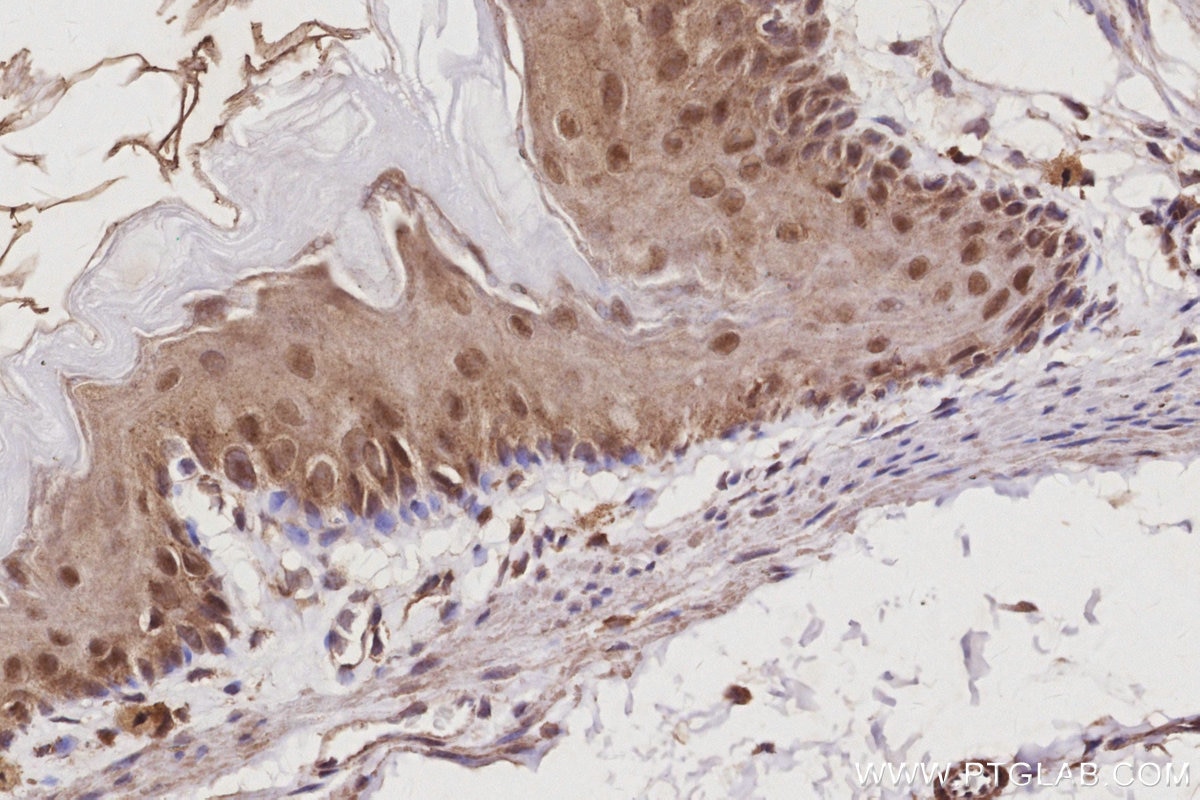 IHC staining of mouse stomach using 13126-1-AP Immunohistochemistry (IHC) staining of mouse stomach tissue using USP24 Polyclonal antibody (13126-1-AP)