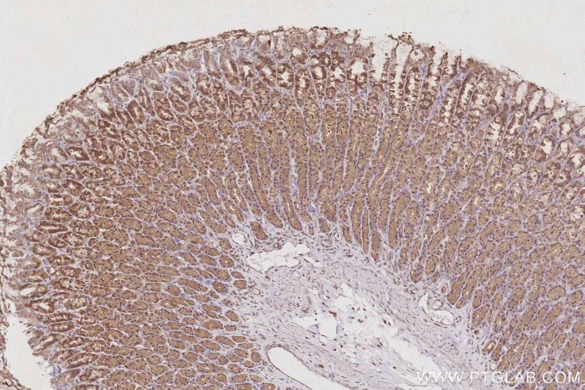 IHC staining of rat stomach using 13126-1-AP Immunohistochemistry (IHC) staining of rat stomach tissue using USP24 Polyclonal antibody (13126-1-AP)