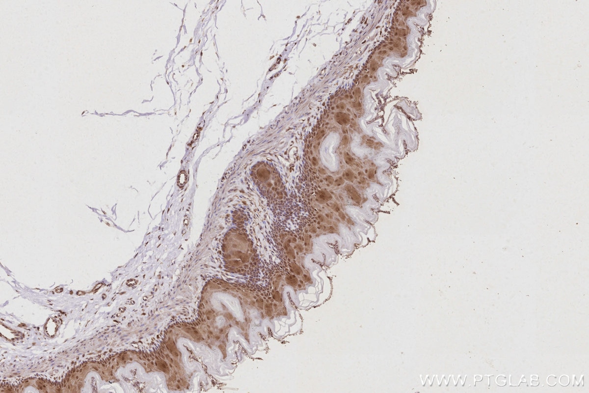 IHC staining of rat stomach using 13126-1-AP Immunohistochemistry (IHC) staining of rat stomach tissue using USP24 Polyclonal antibody (13126-1-AP)