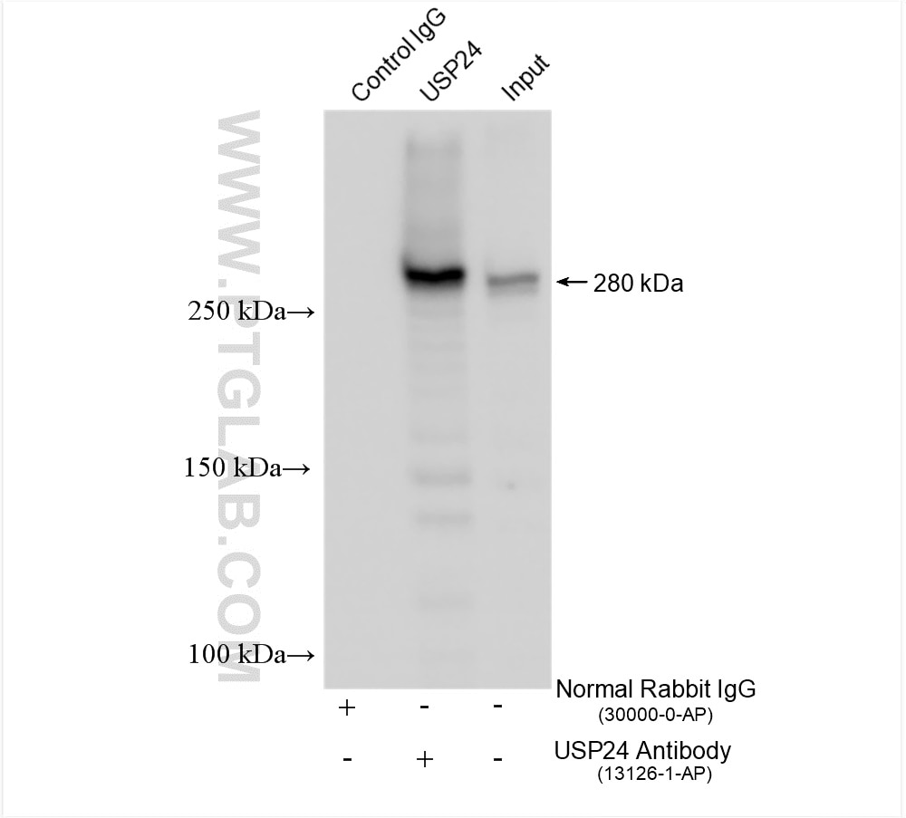Immunoprecipitation (IP) experiment of mouse brain tissue using USP24 Polyclonal antibody (13126-1-AP)