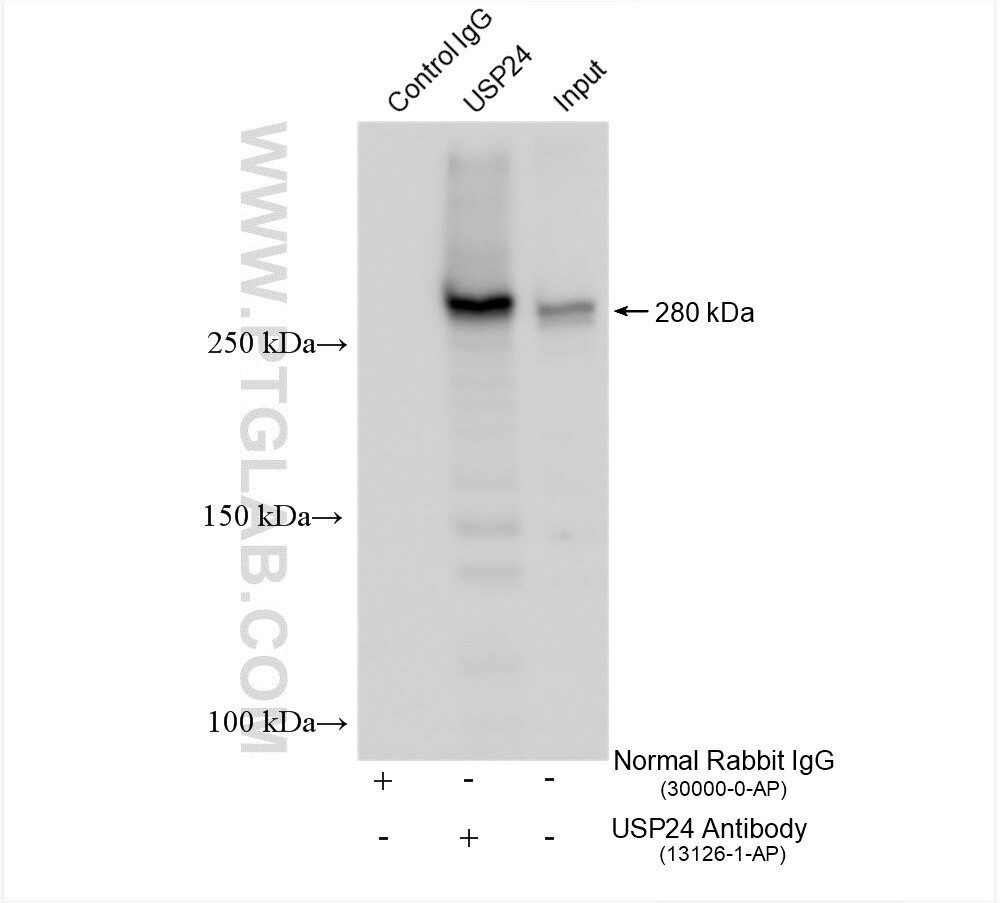 IP experiment of mouse brain using 13126-1-AP