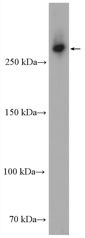 Western Blot (WB) analysis of HepG2 cells using USP24 Polyclonal antibody (13126-1-AP)