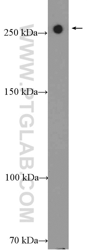 Western Blot (WB) analysis of rat lung tissue using USP24 Polyclonal antibody (13126-1-AP)