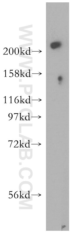 Western Blot (WB) analysis of mouse lung tissue using USP24 Polyclonal antibody (13126-1-AP)