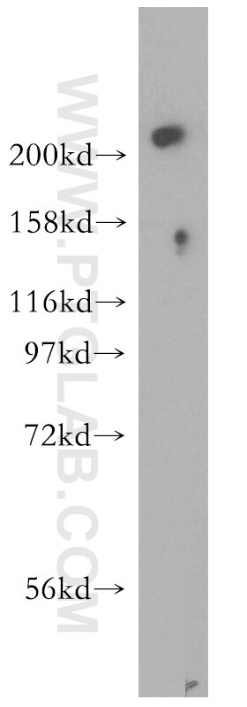 WB analysis of mouse lung using 13126-1-AP