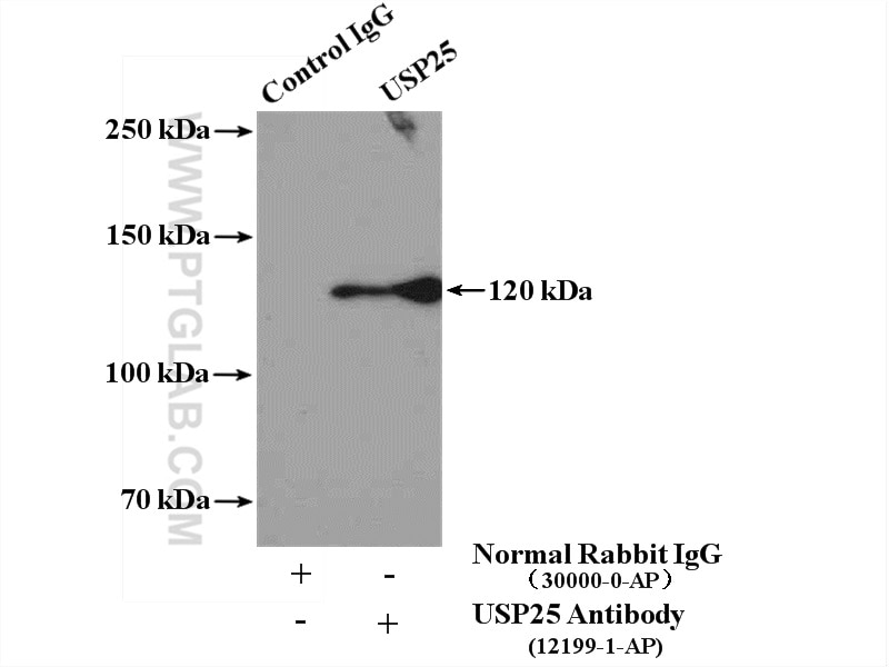 Immunoprecipitation (IP) experiment of RAW 264.7 cells using USP25 Polyclonal antibody (12199-1-AP)