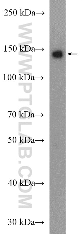 Western Blot (WB) analysis of mouse cerebellum tissue using USP25 Polyclonal antibody (12199-1-AP)