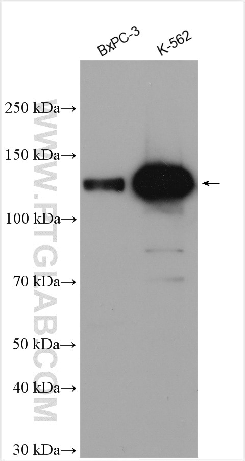 Western Blot (WB) analysis of various lysates using USP25 Polyclonal antibody (12199-1-AP)