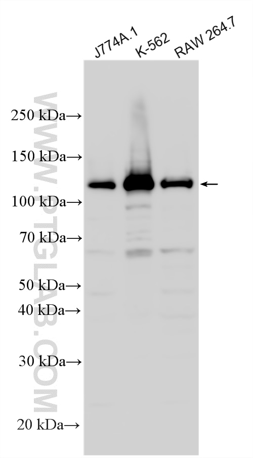 Western Blot (WB) analysis of various lysates using USP25 Polyclonal antibody (12199-1-AP)